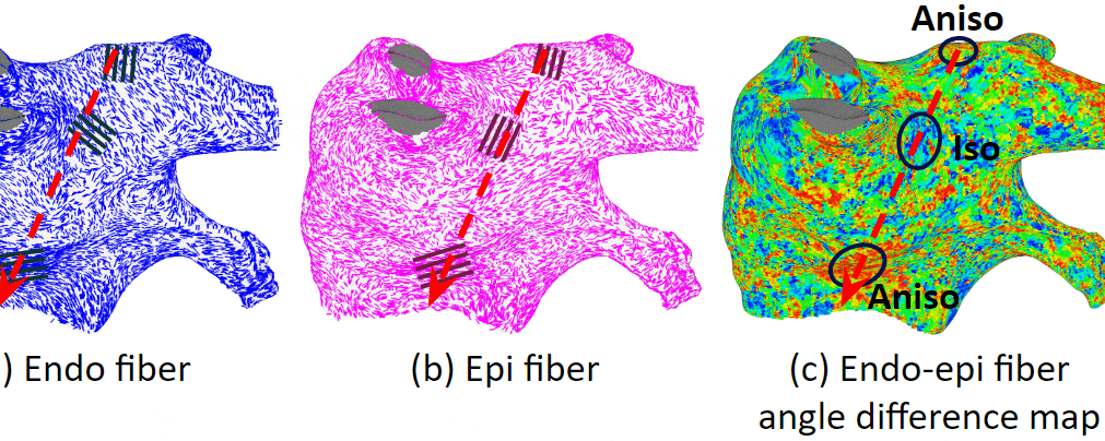 Myocardial fiber effects on arrhythmia activation patterns