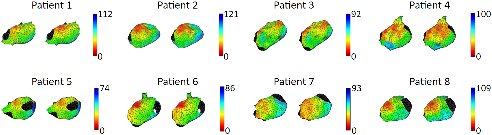 Patient simulation LAT maps – SR